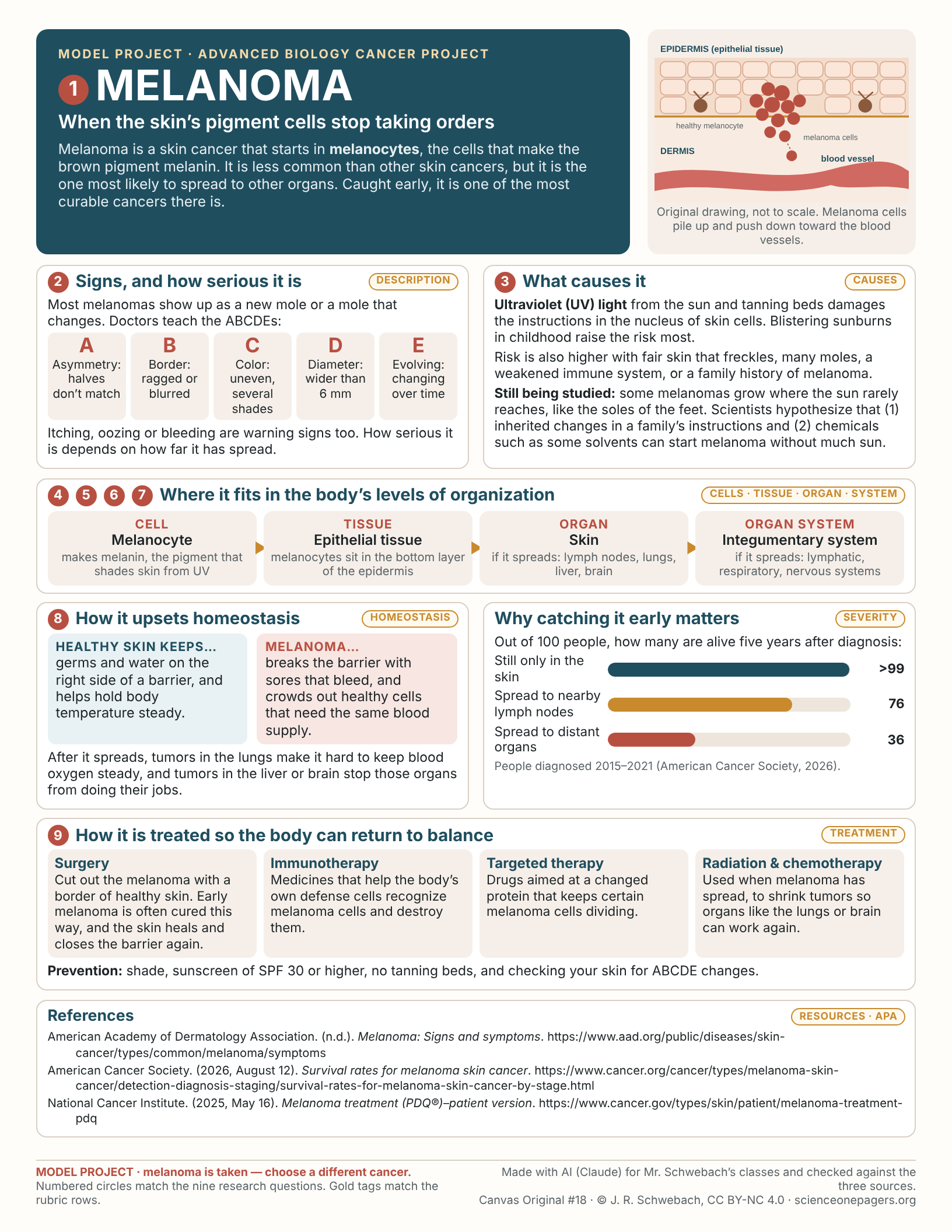 Model project infographic on melanoma: signs, causes, levels of organization from melanocyte to integumentary system, homeostasis, five-year survival by stage, treatments and three APA references.